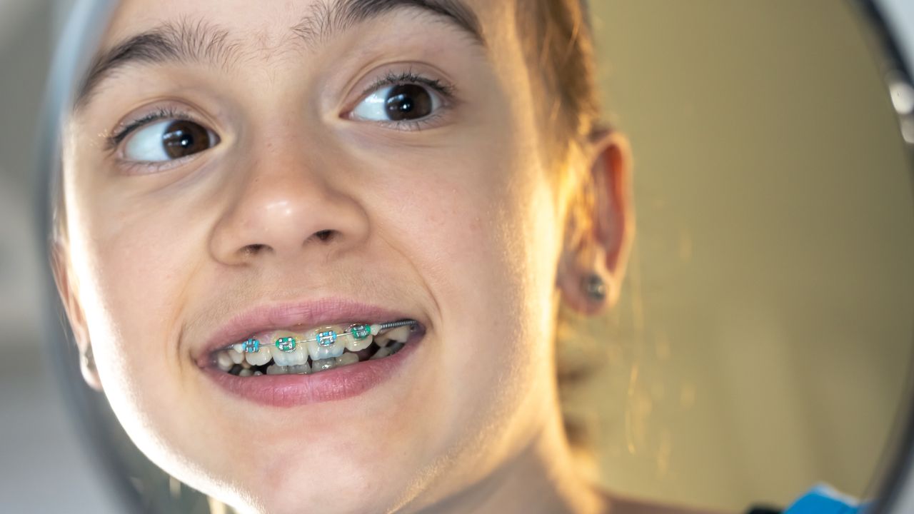 Frequência Ideal de Consultas Odontológicas Durante o Tratamento - inspiração 2