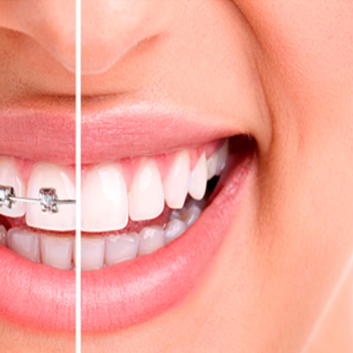 A Higiene Bucal é o Primeiro Passo Essencial - inspiração 2