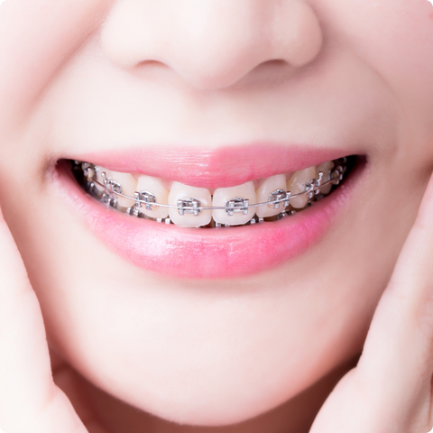 Alimentação Consciente: O Que Evitar para Dentes Mais Brancos - inspiração 1