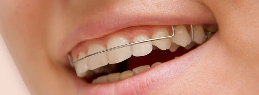 A Importância da Limpeza do Aparelho Móvel - inspiração 1