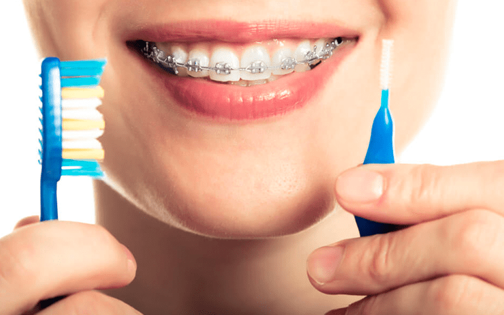 Técnicas Caseiras Seguras para Clarear os Dentes - inspiração 1