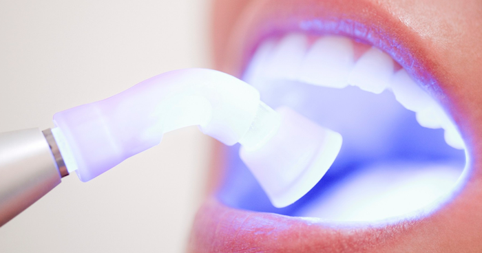 Dicas Extras para Manter o Brilho do Sorriso - inspiração 1