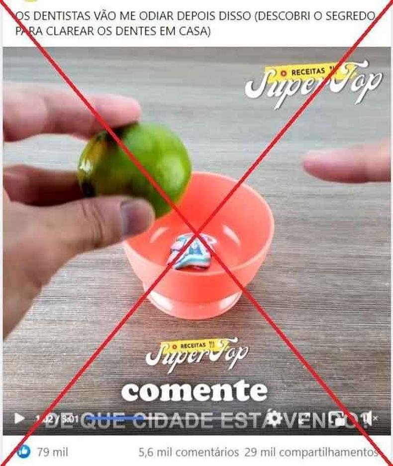 Preparando Seus Dentes para o Clareamento Caseiro - inspiração 1