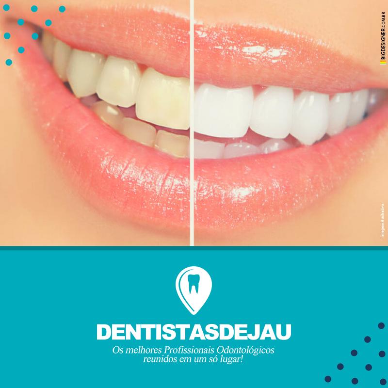 Preparando Seus Dentes para o Clareamento Caseiro - inspiração 2