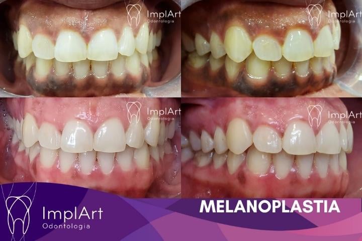 Onde Encontrar as Melhores Laranjas para Este Propósito - inspiração 2