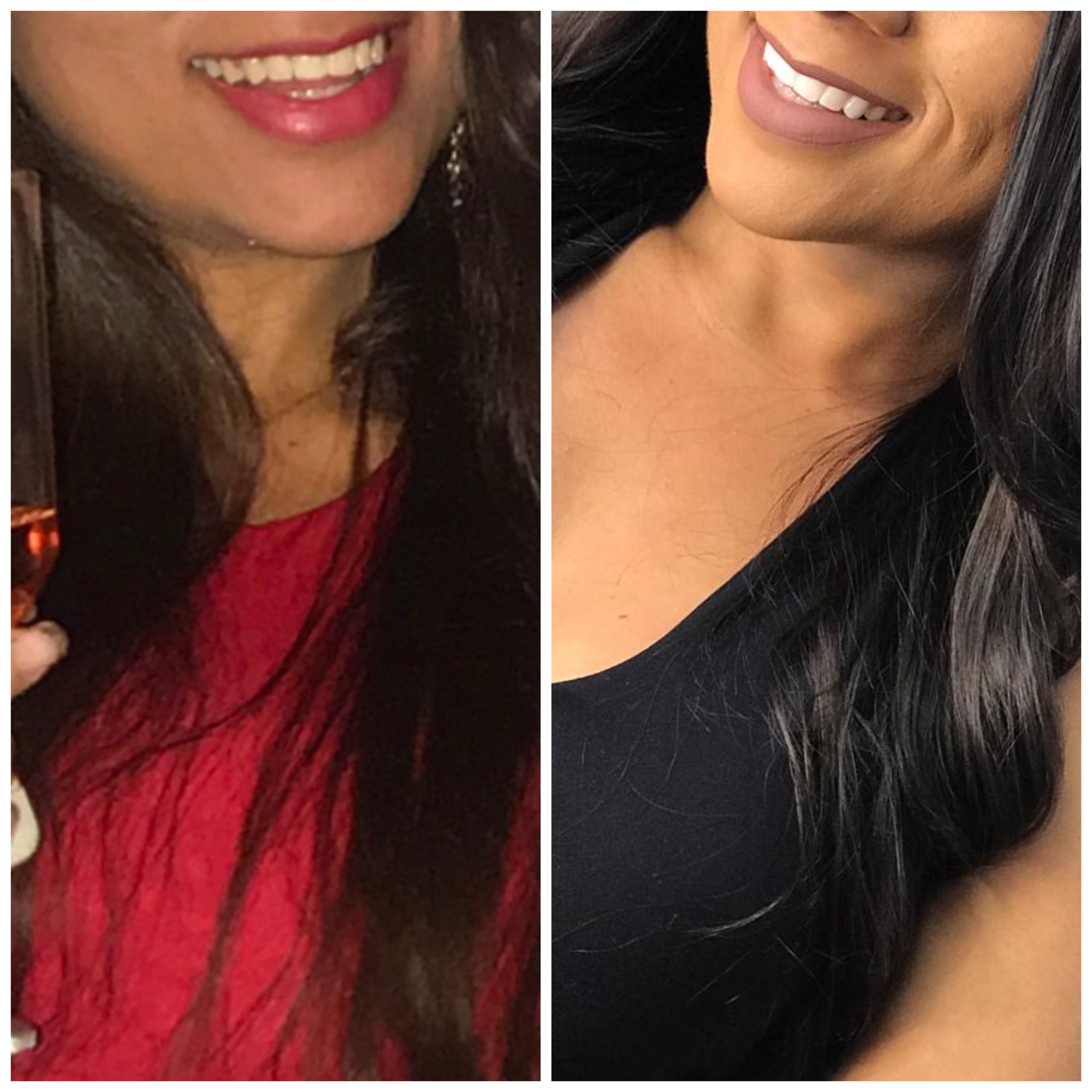 Manutenção do Sorriso Branco: Estratégias para um resultado duradouro - inspiração 2