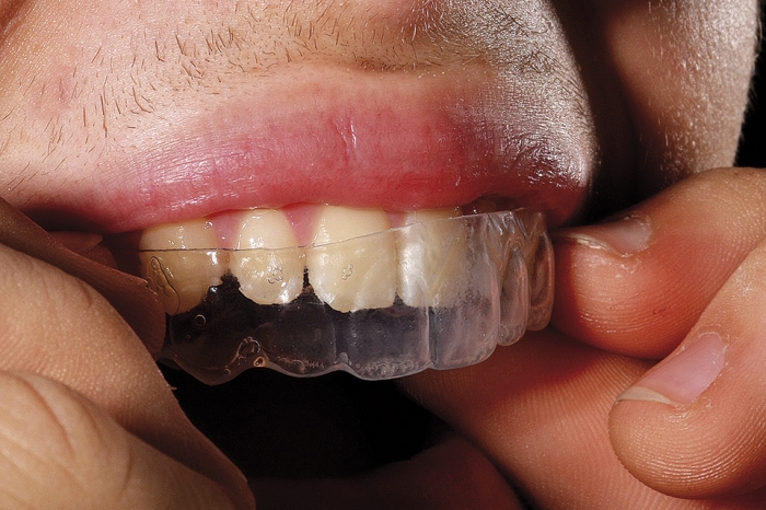 Avaliação Profissional: Por que consultar seu dentista é o primeiro passo indispensável - inspiração 2