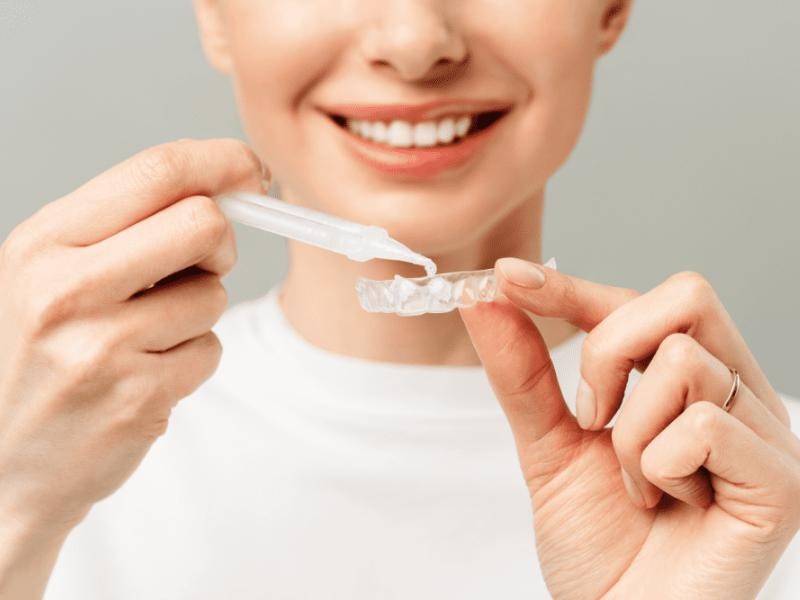 Alimentação e Hábitos: O que evitar durante e após o clareamento para manter os resultados - inspiração 1