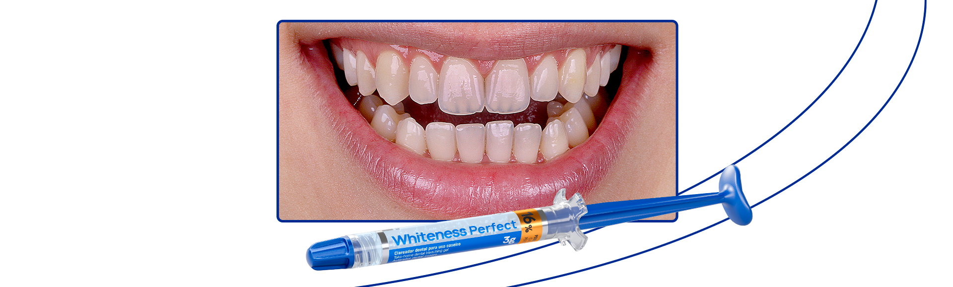 Alimentos e bebidas a evitar para manter o branco - inspiração 1