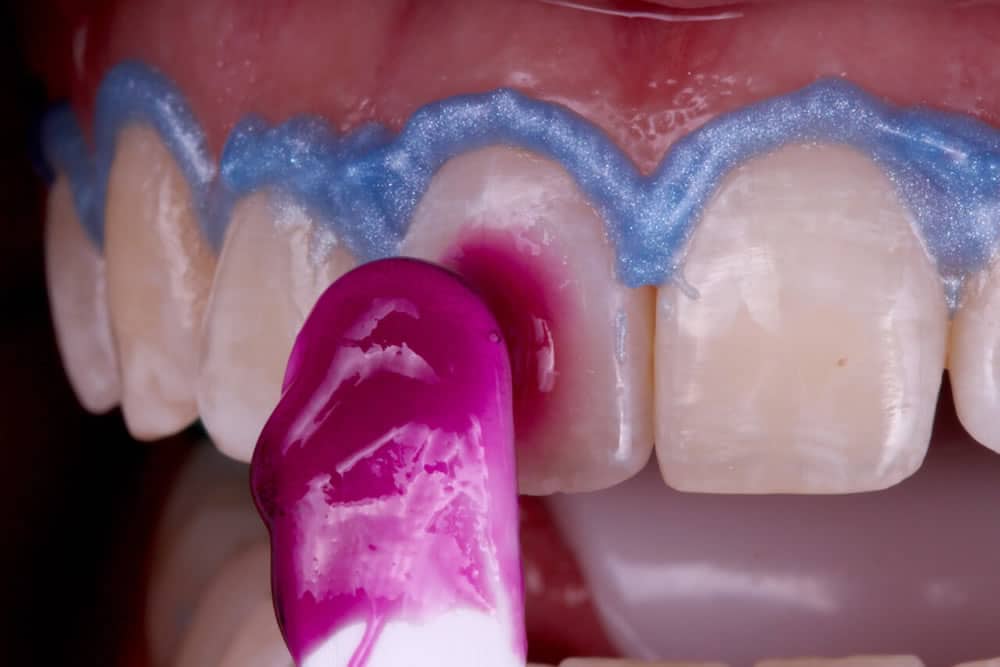 Manutenção do Sorriso Branco: Dicas Práticas para o Dia a Dia - inspiração 1