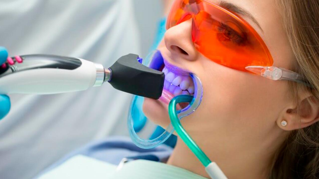 Quem Pode Fazer o Clareamento a Laser e Gel? - inspiração 1