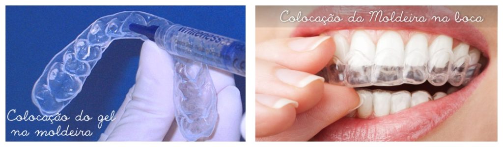 O Tempo de Uso Correto da Moldeira: Não Exagere! - inspiração 1