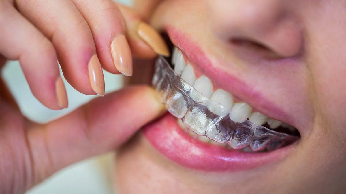 Resultados Esperados e Frequência do Tratamento - inspiração 1