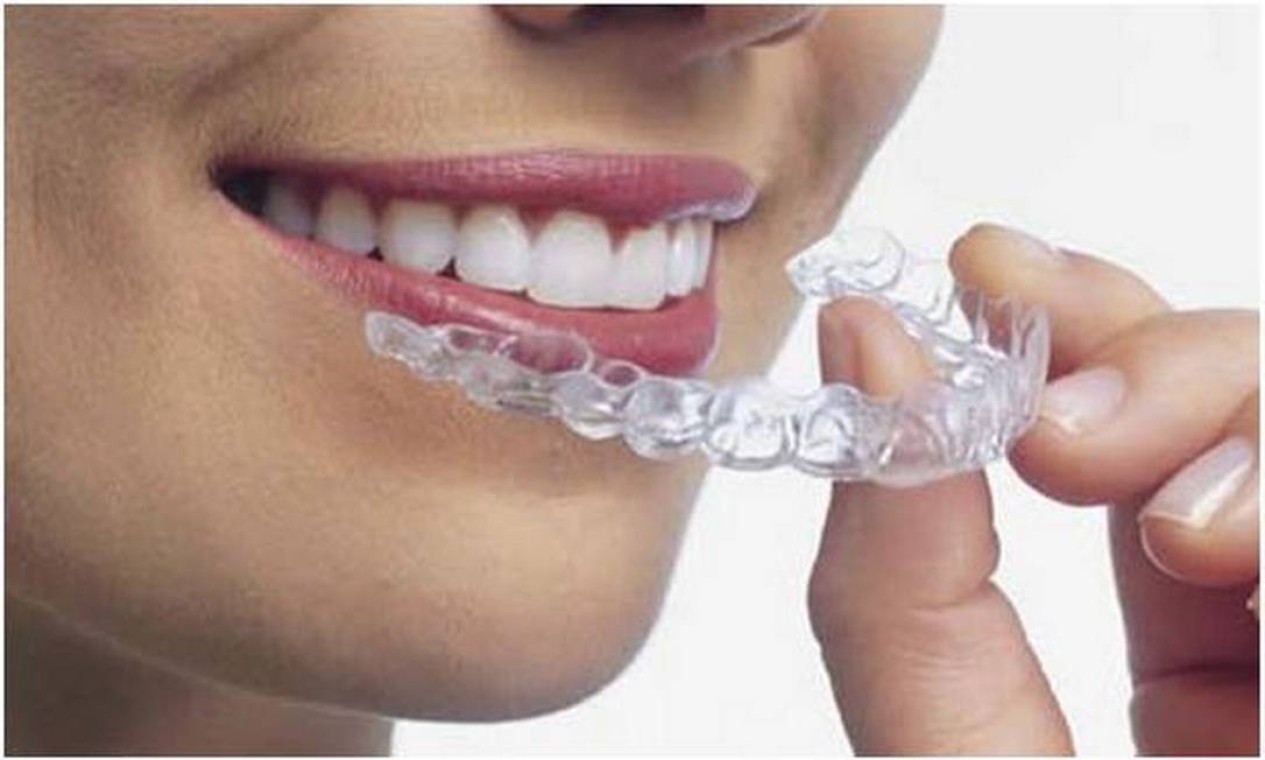 Pastas de Dente Clareadoras: O Básico Diário - inspiração 2