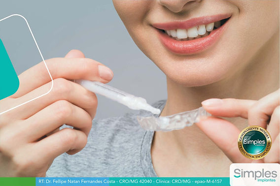 Dicas Extras para Manter o Sorriso Brilhante por Mais Tempo - inspiração 2