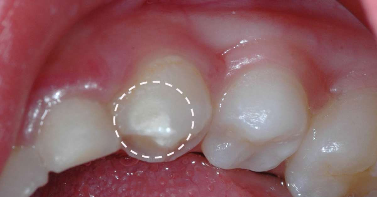 O Uso de Recursos Visuais e Lúdicos na Educação Bucal - inspiração 1