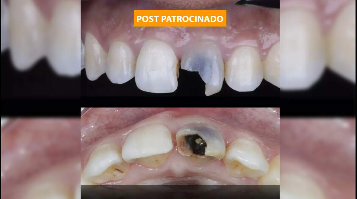 O poder do fio dental: detalhes que fazem a diferença - inspiração 1