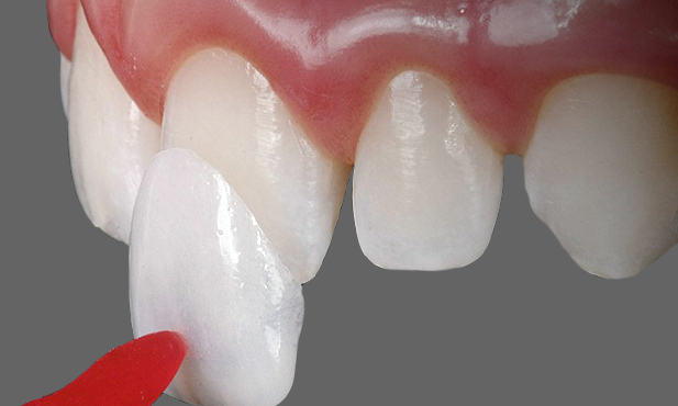 O poder do fio dental: detalhes que fazem a diferença - inspiração 2