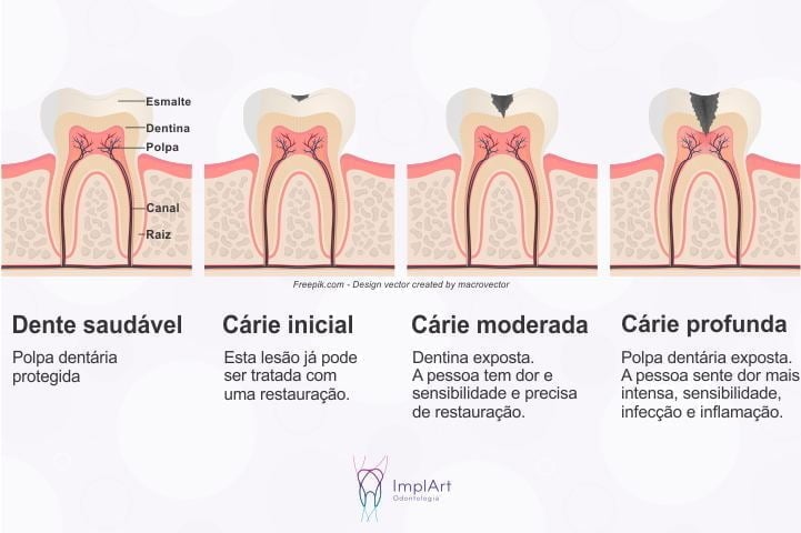 A importância da hidratação para a saúde bucal - inspiração 1