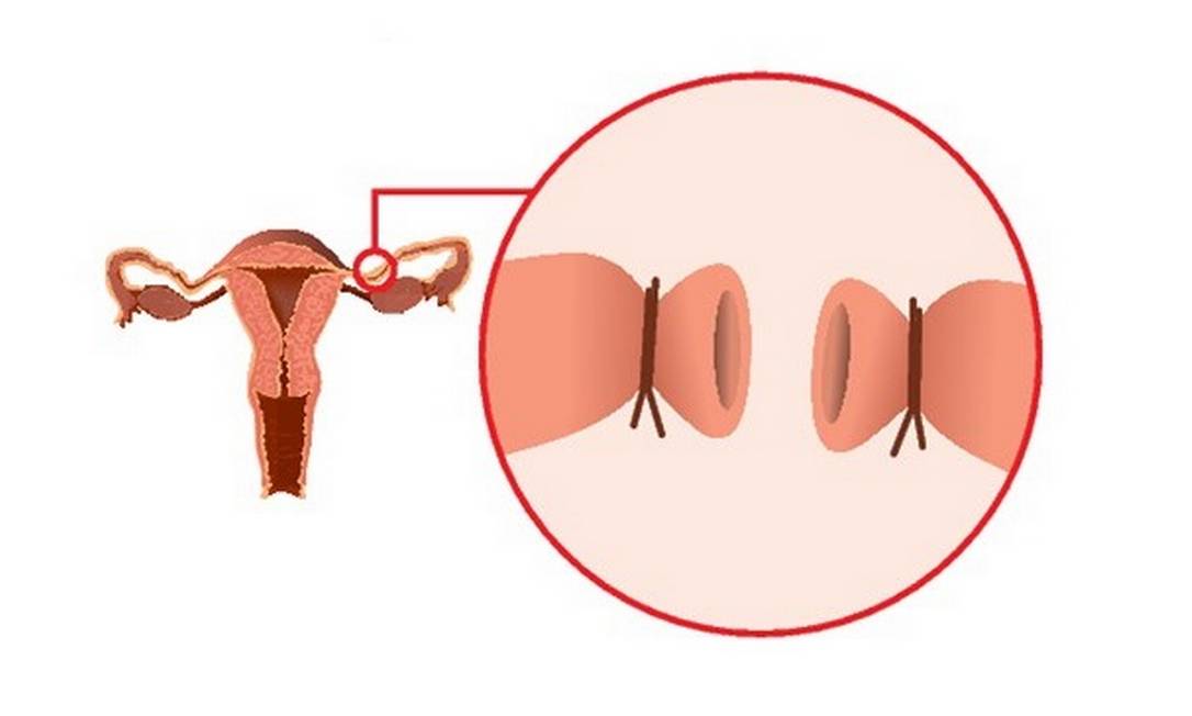 Cuidados pós-gravidez e acompanhamento psicológico - inspiração 1