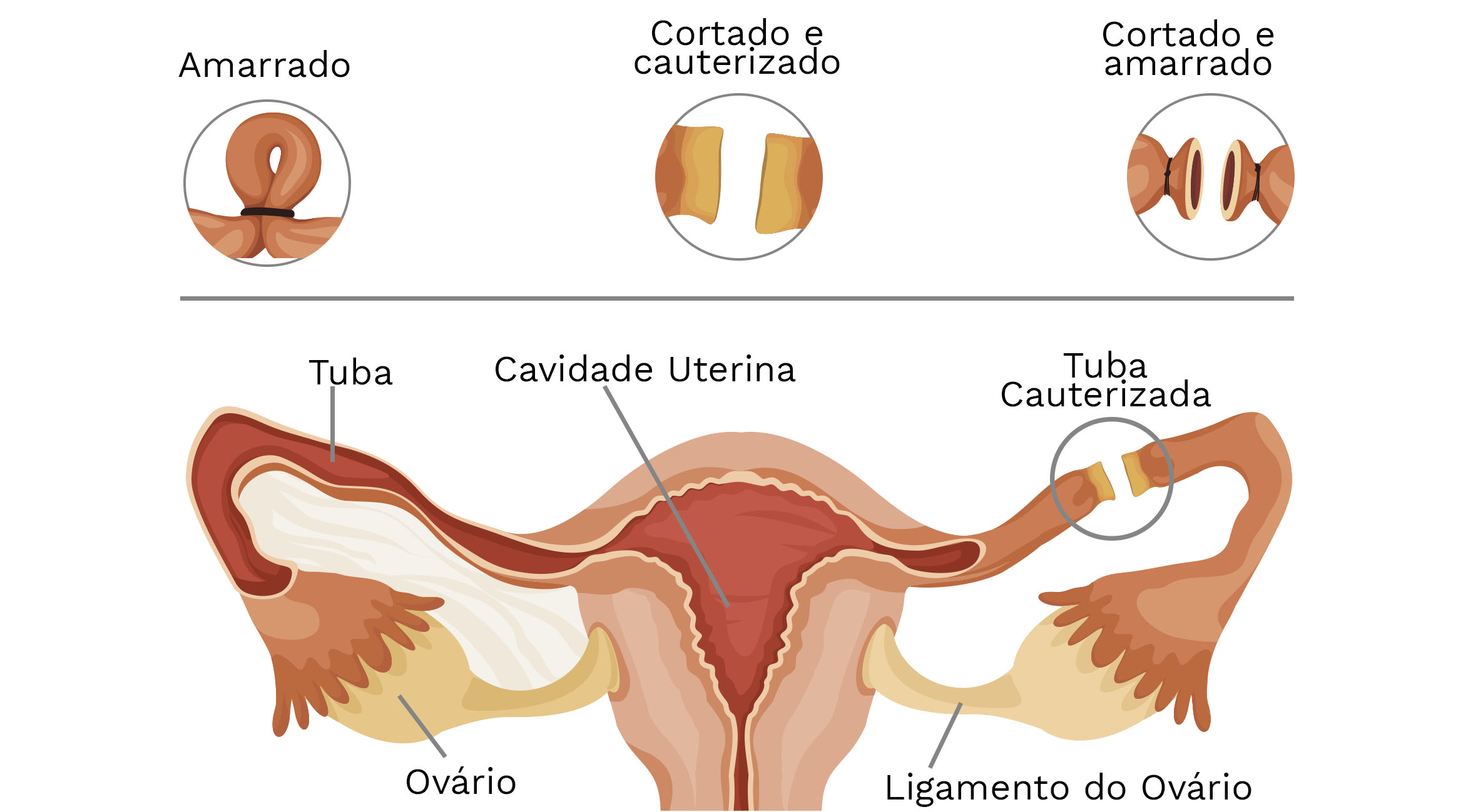 Diagnóstico médico: Confirmando a gravidez - inspiração 1