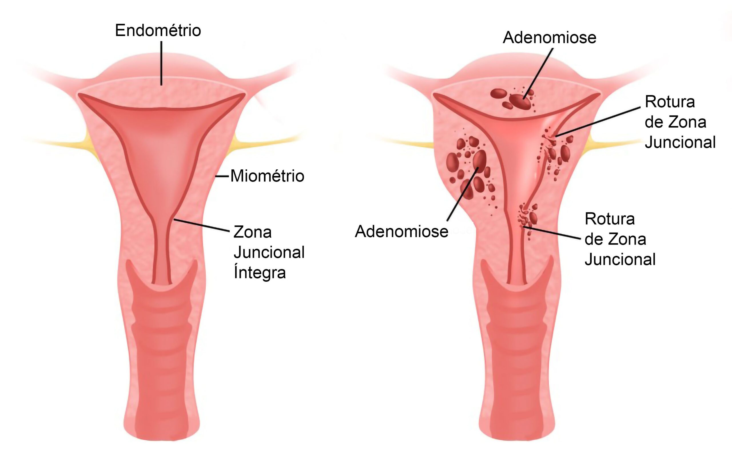 Injeções Contraceptivas: Facilidade e Proteção por Períodos Definidos - inspiração 1