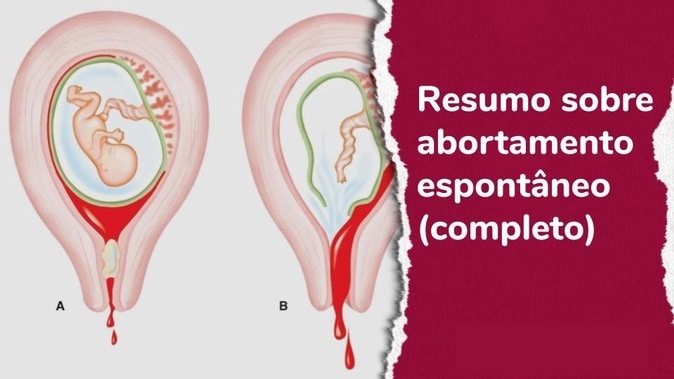 Contraceptivos Orais (Pílulas): Variedade e Como Escolher a Ideal para Você - inspiração 1