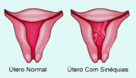 Métodos Naturais e a Importância de Entendê-los com Precisão - inspiração 1