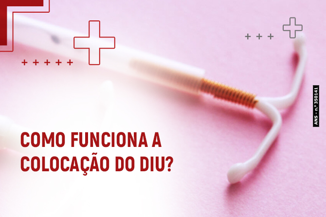 Como o DIU age: Segurança e eficácia comprovadas - inspiração 2