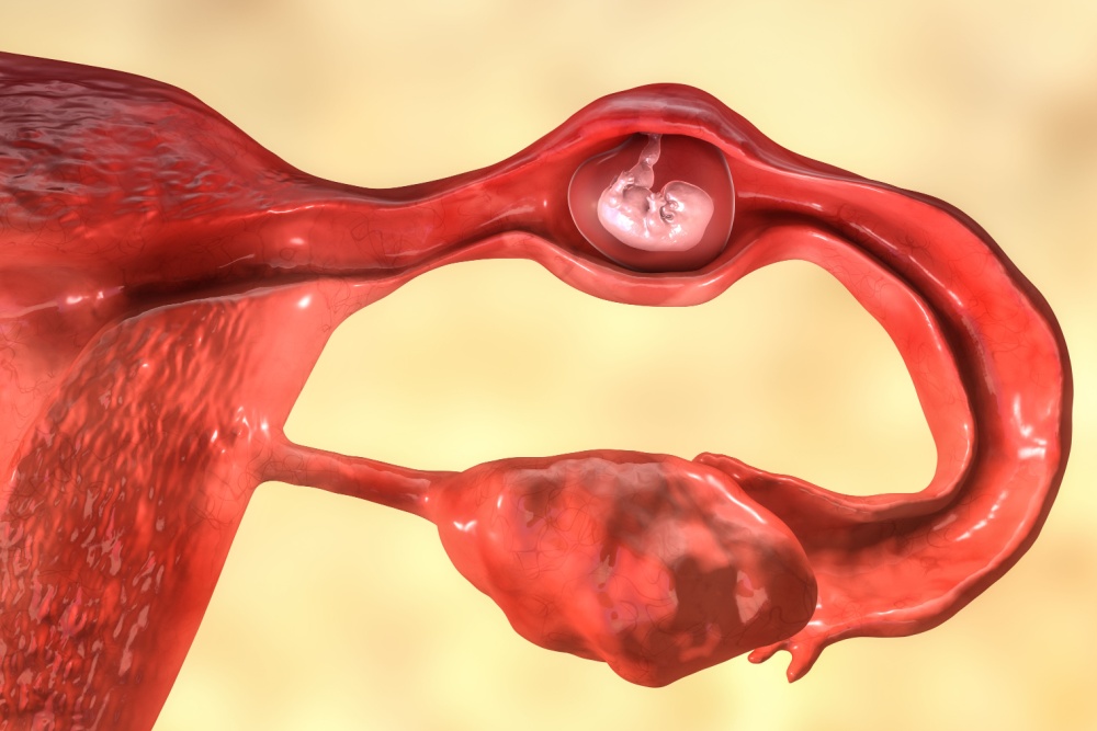 A Importância Crucial do Planejamento Familiar e do Uso de Métodos Contraceptivos Eficazes - inspiração 1