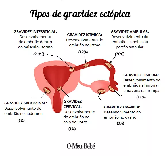 Fique Atenta aos Primeiros Sinais: Sintomas que Exigem Atenção Médica Imediata - inspiração 2