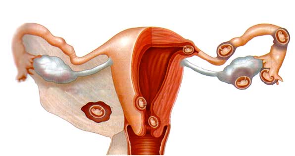 Cirurgias Abdominais Anteriores: Um Fator de Atenção para Sua Saúde - inspiração 1