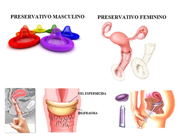 A Escolha Certa do Tamanho do Diafragma: Um Encaixe Perfeito para Sua Segurança - inspiração 1