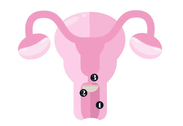 Combinando com Outros Métodos: Estratégias para Dupla Proteção - inspiração 2