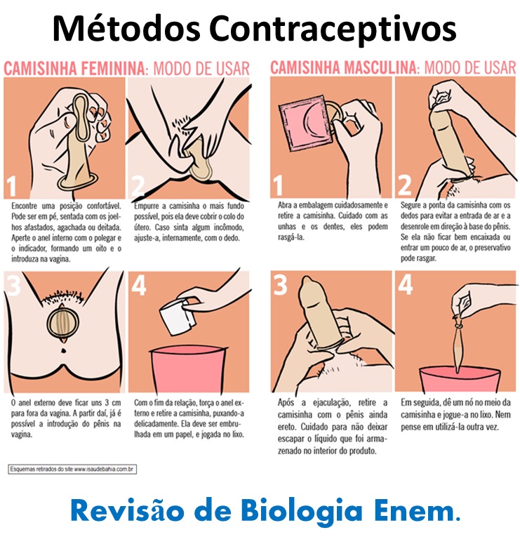 Como Inserir o Diafragma: Técnica e Posição Correta para Evitar Vazamentos - inspiração 1