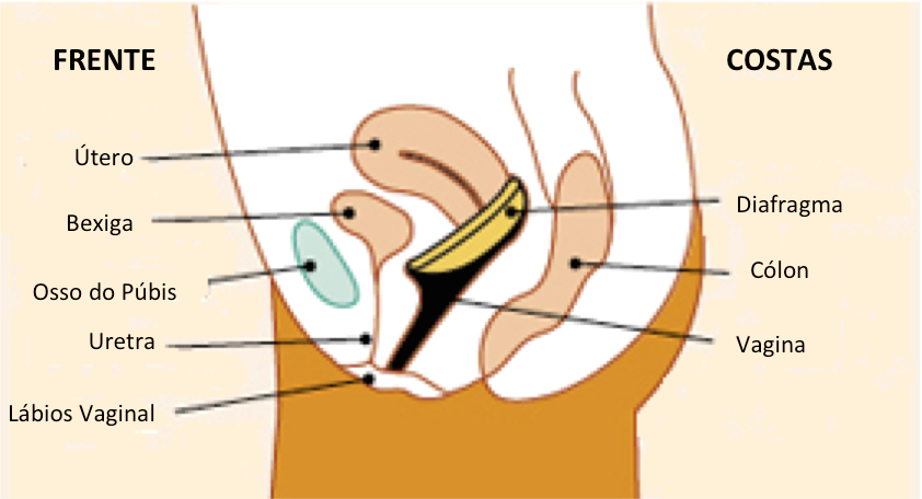 Tempo de Permanência: Quanto Tempo Devo Manter o Diafragma Após o Sexo? - inspiração 2