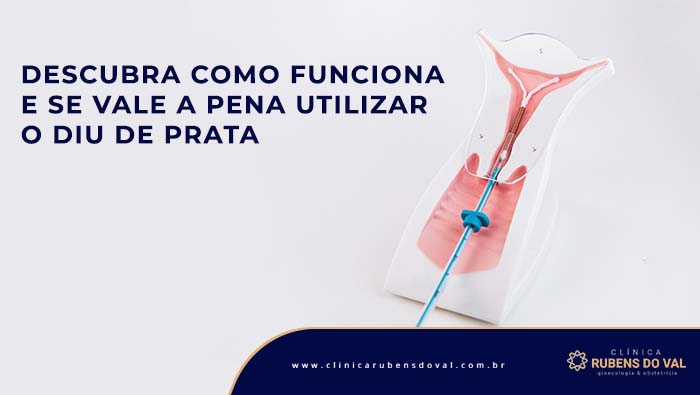 Entendendo o DIU de Prata: Segurança e Eficácia Comprovadas - inspiração 2