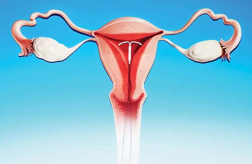 A Camisinha Vai Além da Gravidez: Proteção Contra ISTs - inspiração 1