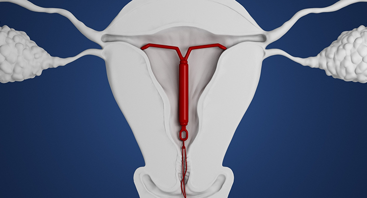 Usando a Camisinha Corretamente: Dicas Práticas - inspiração 2