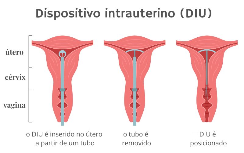 Mitos e Verdades Sobre o Uso Combinado - inspiração 2