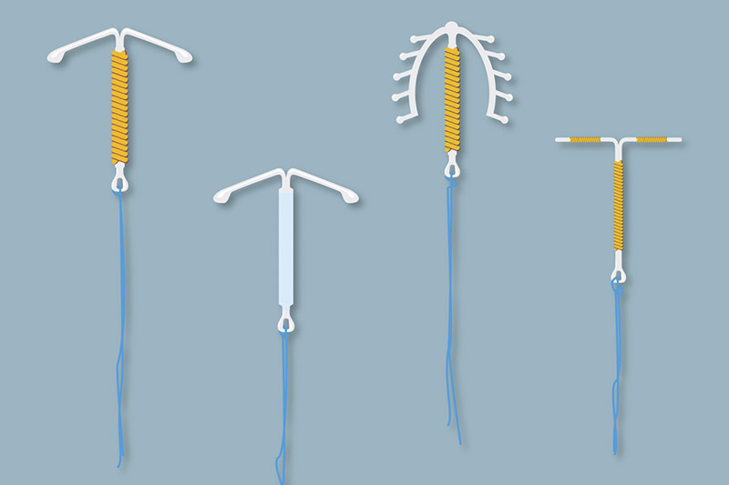 O DIU Hormonal Afeta a Fertilidade Futura? - inspiração 1