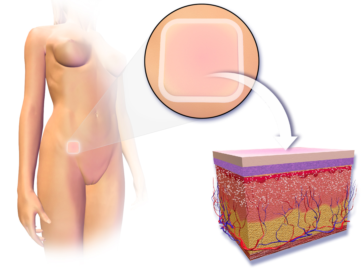 Ciclo de Troca do Adesivo: Mantendo a Eficácia Contínua - inspiração 1