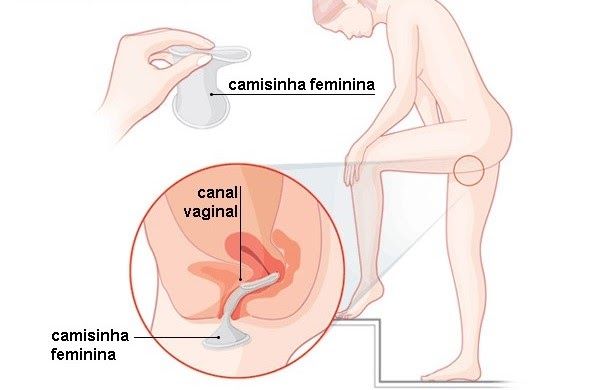 Vantagens e Limitações do Método - inspiração 2