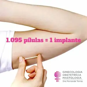 Os Riscos e Efeitos Colaterais do Implante - inspiração 1