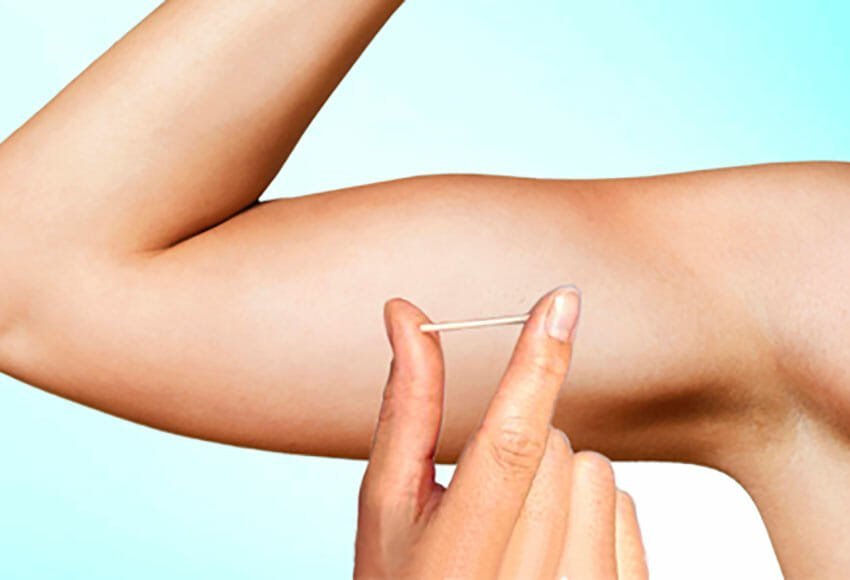 Cuidados Essenciais ao Usar Pílula e Implante Juntos - inspiração 2