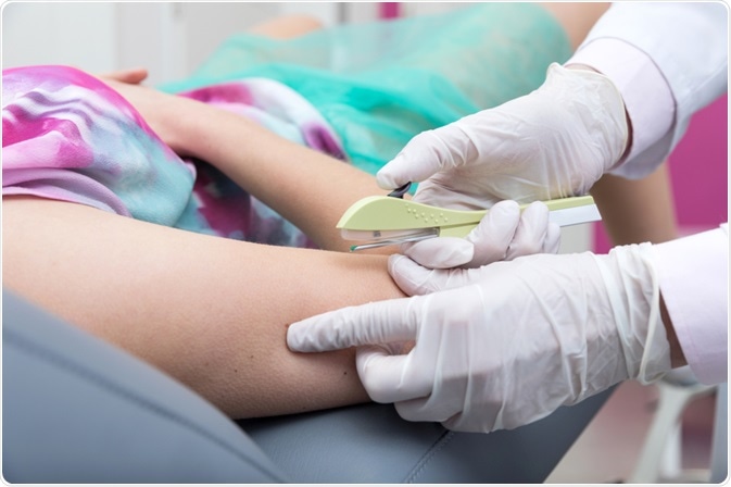 O Que Fazer se Esquecer de Tomar a Pílula - inspiração 1