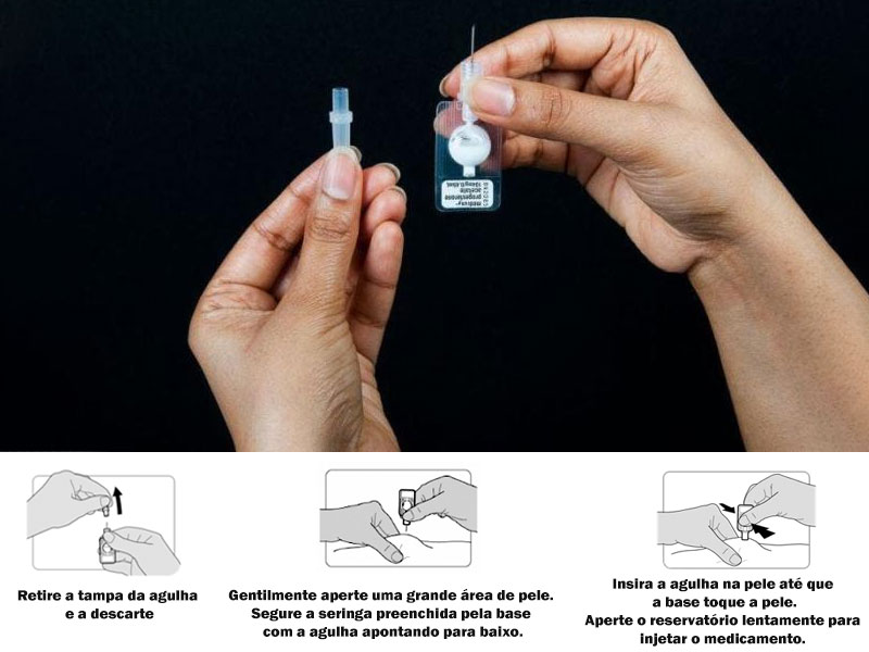 Vantagens do Adesivo: Discrição e Facilidade de Uso - inspiração 1