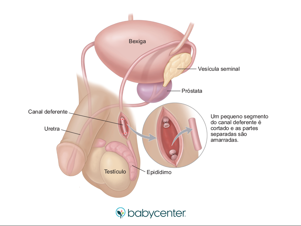 Principais Benefícios da Injeção: Menos Preocupação Diária - inspiração 2