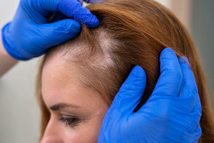 Cuidados Essenciais Para Um Couro Cabeludo Saudável - inspiração 1