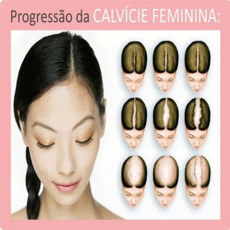 Opções Terapêuticas Comprovadas para o Rejuvenescimento Capilar - inspiração 2